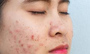 Health News  Skin Allergies Skin Disorders