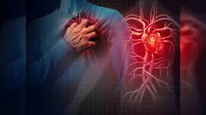 Silent pain of the heart